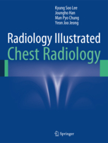 Radiology Illustrated: Chest Radiology