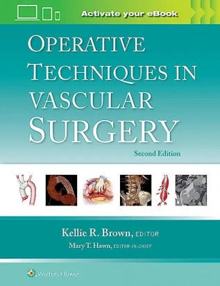 Operative Techniques in Vascular Surgery, Second edition