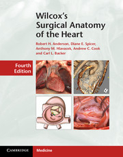 Wilcox's Surgical Anatomy of the Heart  4th Edition