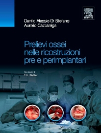 Prelievi ossei nelle ricostruzioni pre e perimplantari, 1st Edition