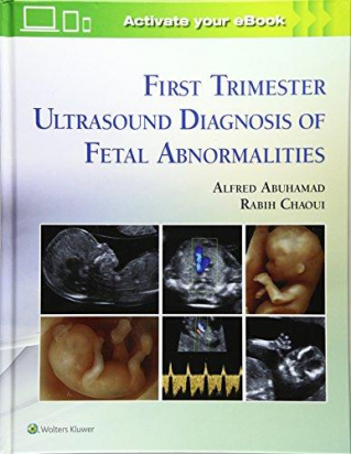 First Trimester Ultrasound Diagnosis of Fetal Abnormalities 