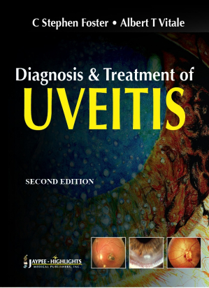 Diagnosis &amp; Treatment of Uveitis