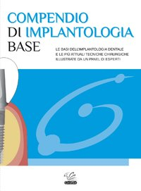 Compendio di Implantologia Base