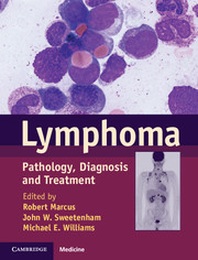 Lymphoma - Pathology, Diagnosis, and Treatment - 2nd Edition