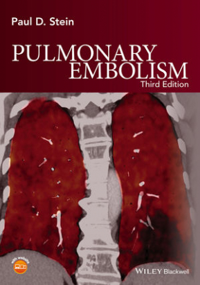 Pulmonary Embolism, 3rd Edition