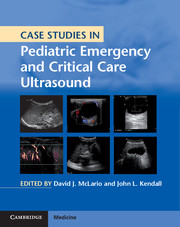 Case Studies in Pediatric Emergency and Critical Care Ultrasound