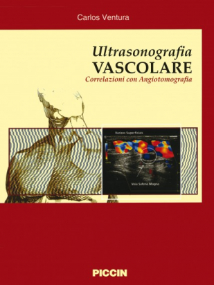 Ultrasonografia vascolare