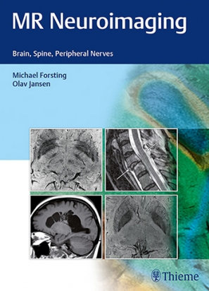 MR Neuroimaging