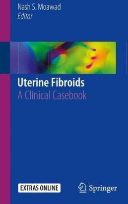 Uterine Fibroids