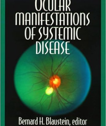Ocular Manifestations of Systemic Disease