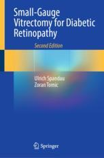 Small-Gauge Vitrectomy for Diabetic Retinopathy 2ed