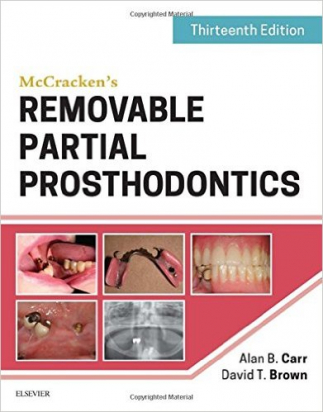 McCracken's Removable Partial Prosthodontics , 13th Edition