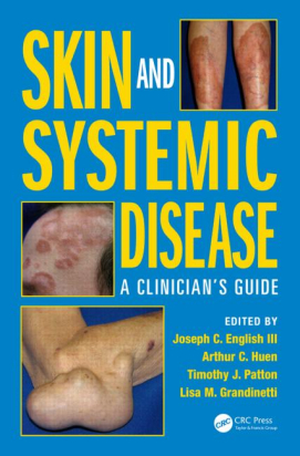 Skin and Systemic Disease