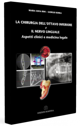 La Chirurgia dell'Ottavo Inferiore e il Nervo Linguale