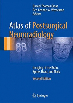 Atlas of Postsurgical Neuroradiology 2nd ed