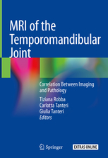 MRI of the Temporomandibular Joint 