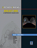 Specialty Imaging: Breast MRI