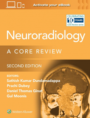 Neuroradiology A Core Review, Second edition