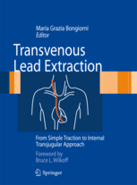 Transvenous Lead Extraction