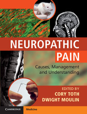 Neuropathic Pain