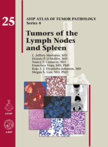 AFIP 4  Fasc.25 Tumors of the Lymph Node and Spleen