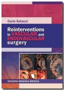 Reinterventions in vascular and endovascular surgery