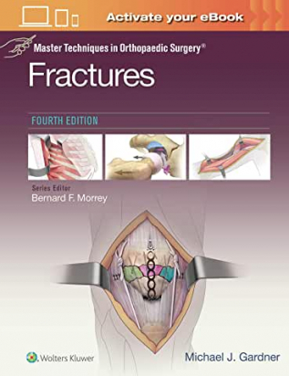 Master Techniques in Orthopaedic Surgery: Fractures - 4th Edition
