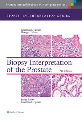 Biopsy Interpretation of the Prostate, 5e