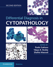 Differential Diagnosis in Cytopathology