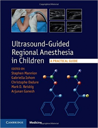 Ultrasound-Guided Regional Anesthesia in Children