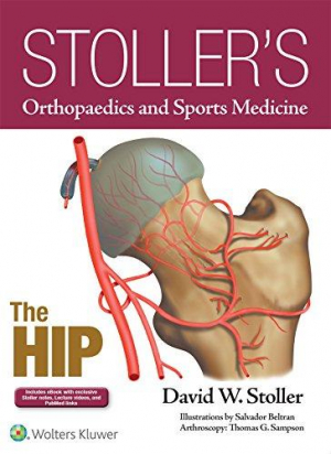 Stoller's Orthopaedics and Sports Medicine: The Hip, 1e 