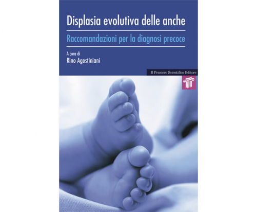 Displasia Evolutiva delle Anche