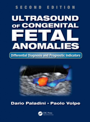 Ultrasound of Congenital Fetal Anomalies: Differential Diagnosis and Prognostic Indicators, Second Edition