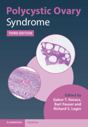 Polycystic Ovary Syndrome 3rd edition
