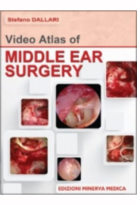 Video atlas of middle ear surgery