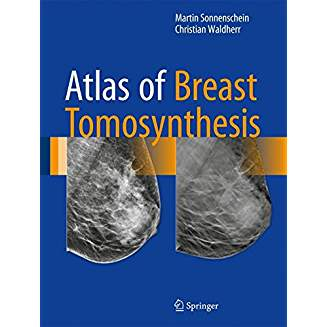 Atlas of Breast Tomosynthesis