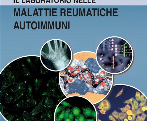 Il laboratorio nelle Malattie Reumatiche Autoimmuni