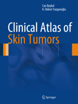 Clinical Atlas of Skin Tumors