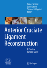 Anterior Cruciate Ligament Reconstruction