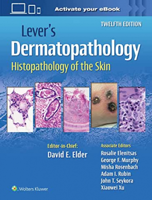 Lever's Dermatopathology: Histopathology of the Skin Twelfth edition