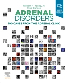 Adrenal Disorders