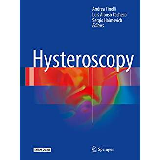 Hysteroscopy