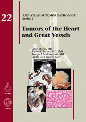 AFIP 4  Fasc. 22 Tumors of the Heart and Great Vessels