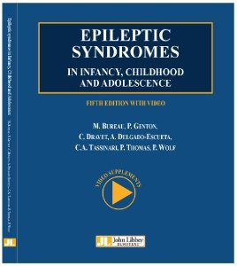 Epileptic syndromes in infancy, childhood and adolescence