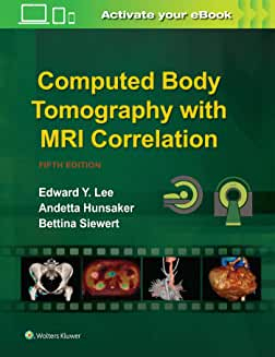 Computed Body Tomography with MRI Correlation Fifth edition