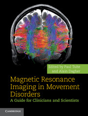 Magnetic Resonance Imaging in Movement Disorders
