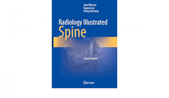Radiology Illustrated: Spine 2nd edition