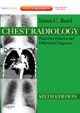 Chest Radiology, 6th Edition