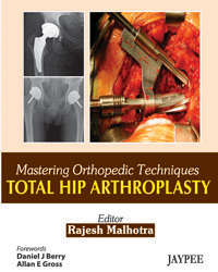 Mastering Orthopedic Techniques: Total Hip Arthroplasty