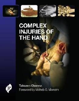 Complex Injuries of the Hand